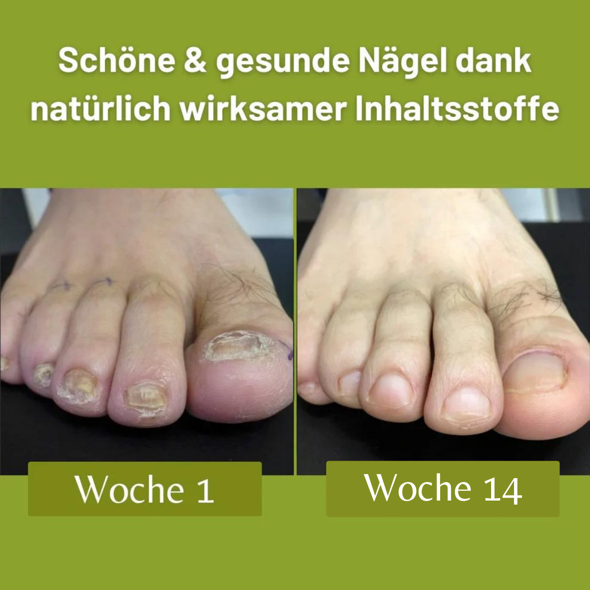 Onyko-Peptid® Komplex - Mit Oregano-Extrakt