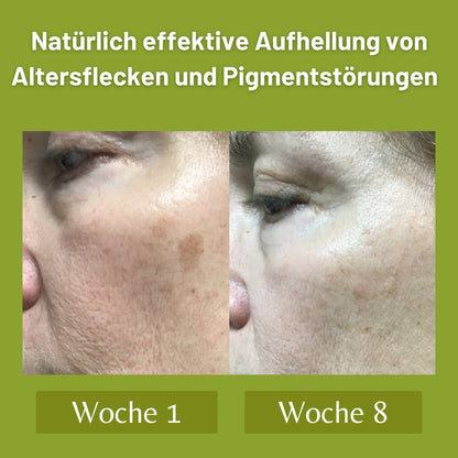 Melanoxyl Pro® - Auf Basis von Lavendel-Extrakt